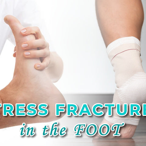 The Best Treatments for Stress Fractures in the Foot