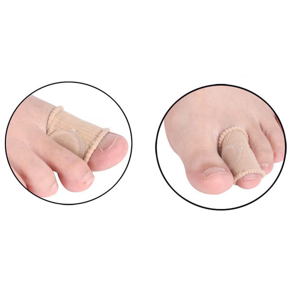 Hammer Toe Products | Effective Treatments, Correctors and Pain Relief ...